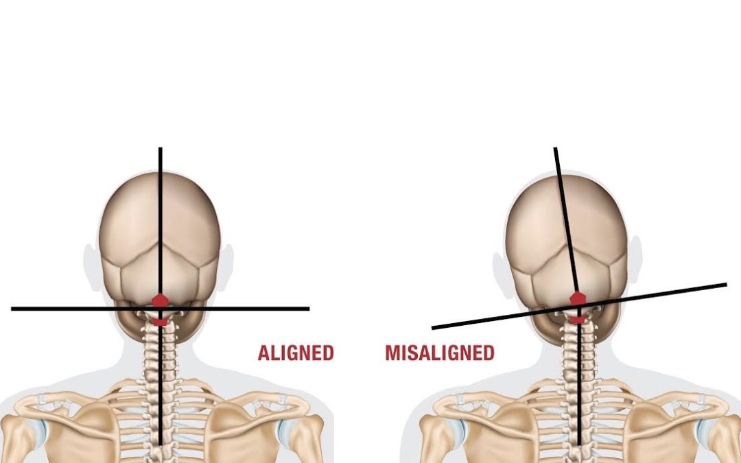 How Do Chiropractic Adjustments Work? Chiropractic Adjustment FAQs